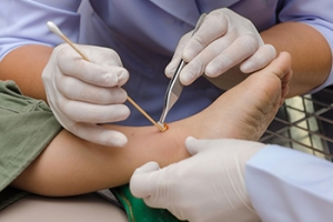 Diabetes Inhibits Foot Wound Healing