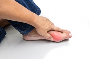 Facts About Gout Attacks