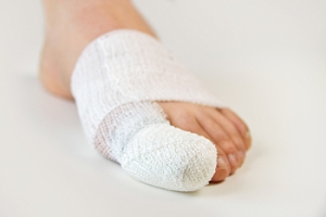 Managing a Broken Toe