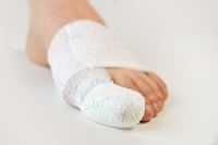 Managing a Broken Toe