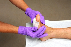 How Are Foot Wounds Treated?