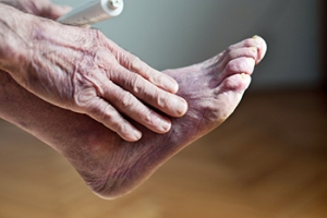 What Are the Symptoms of Poor Circulation?
