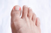 Growth of Toenails